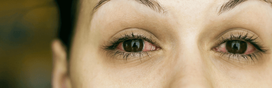 What To Do When High Becomes Too High - HEMPER