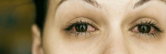 What To Do When High Becomes Too High